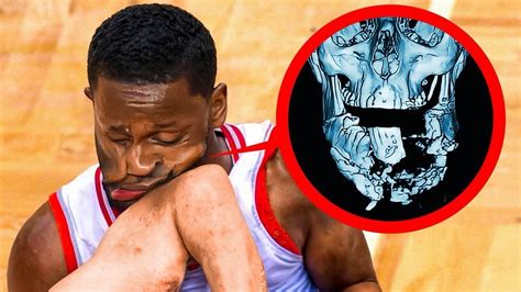 rotoworld nba injuries|NBA Injury Status .